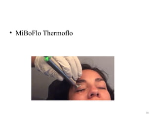 70
• MiBoFlo Thermoflo
 