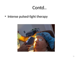 71
Contd..
• Intense pulsed-light therapy
 