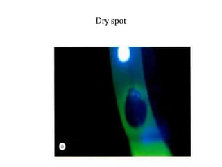 Dry spot
 