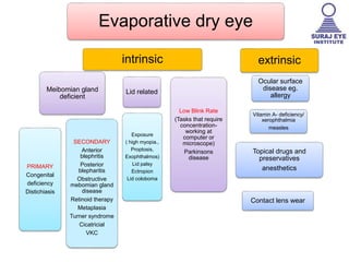 Evaporative dry eye
Meibomian gland
deficient
PRIMARY
Congenital
deficiency
Distichiasis
SECONDARY
Anterior
blephritis
Posterior
blepharitis
Obstructive
mebomian gland
disease
Retinoid therapy
Metaplasia
Turner syndrome
Cicatricial
VKC
Lid related
Low Blink Rate
(Tasks that require
concentration-
working at
computer or
microscope)
Parkinsons
disease
Exposure
( high myopia.,
Proptosis,
Exophthalmos)
Lid palsy
Ectropion
Lid coloboma
intrinsic extrinsic
Vitamin A- deficiency/
xerophthalmia
measles
Ocular surface
disease eg.
allergy
Topical drugs and
preservatives
anesthetics
Contact lens wear
 