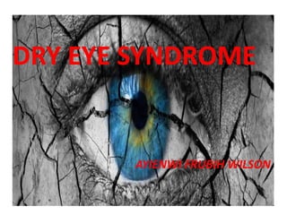 DRY EYE SYNDROME
AYIENWI FRUBIH WILSON
 