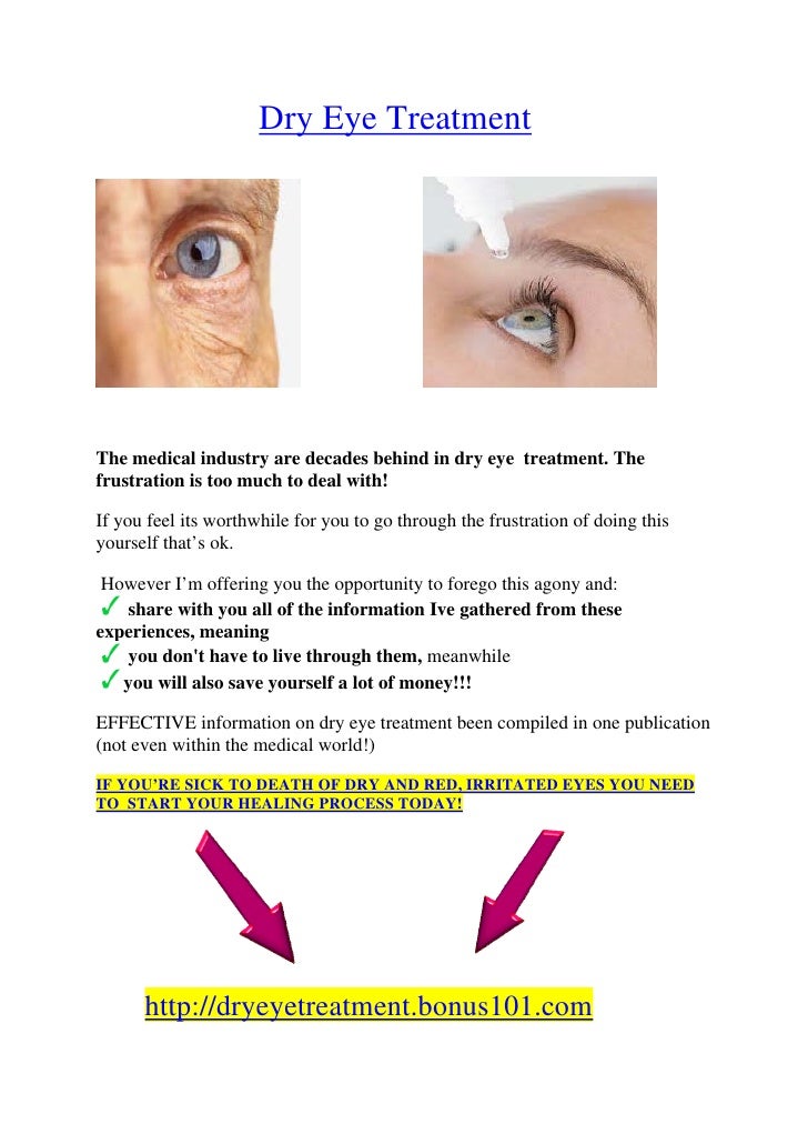 Natural Cure For Sjogren Syndrome Natural Cure For Sjogren Syndrome