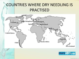 COUNTRIES WHERE DRY NEEDLING IS
PRACTISED
 