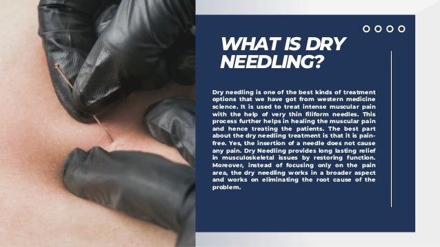 Filiform Needling Dry Needling Therapy Reasons and Benefits.pdf