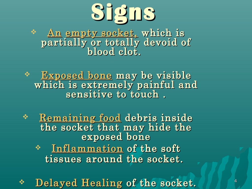 Dry Socket Examples Dry Socket Examples