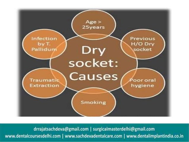 How To Treat Dry Socket In Mouth