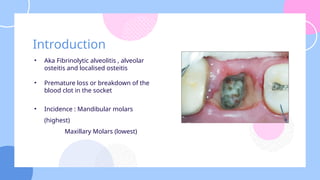 Dry Socket after extraction - clinical features, pathophysiology and t ...