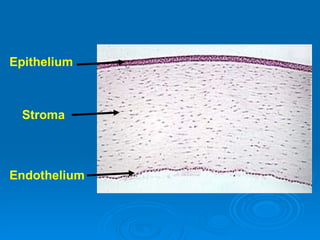 Epithelium



 Stroma



Endothelium
 