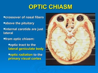 OPTIC CHIASM
crossover     of nasal fibers
above     the pituitary
internal   carotids are just
lateral
from     optic chiasm:
   optic  tract to the
   lateral geniculate body
   opticradiation to the
   primary visual cortex
 