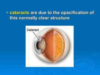  cataracts are due to the opacification of
 this normally clear structure
 