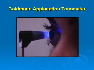 Goldmann Applanation Tonometer
 