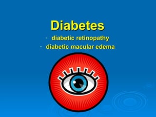 Diabetes
    - diabetic retinopathy
-   diabetic macular edema
 