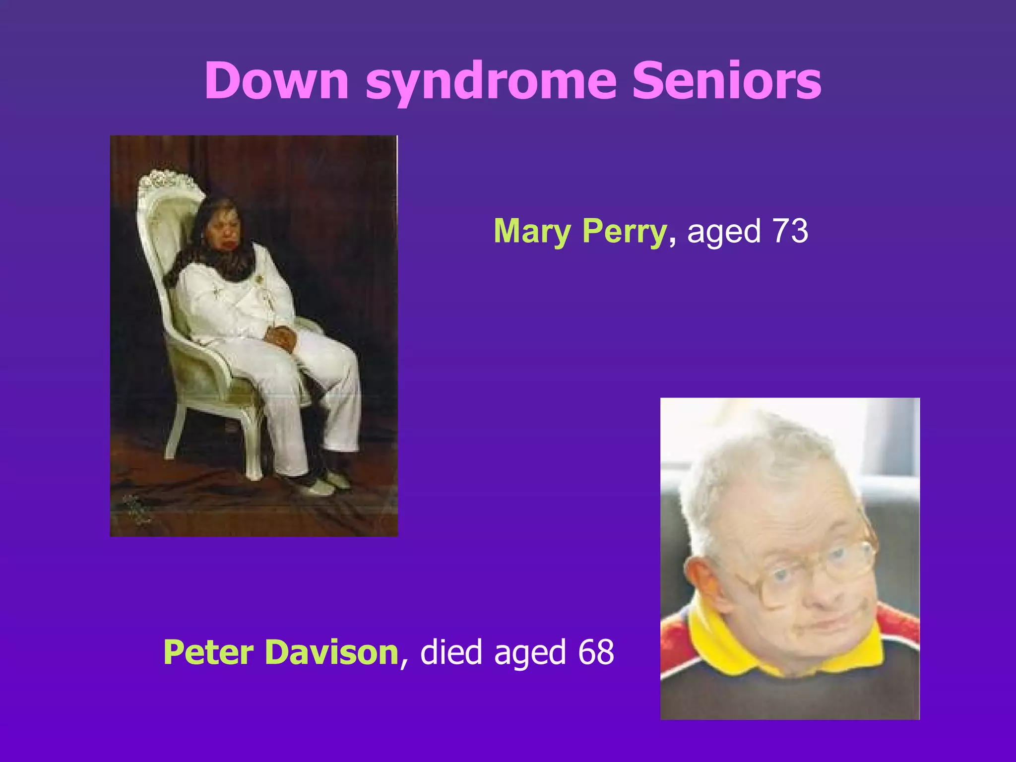 Down syndrome Seniors Peter Davison , died aged 68 Mary Perry ,  aged 73 