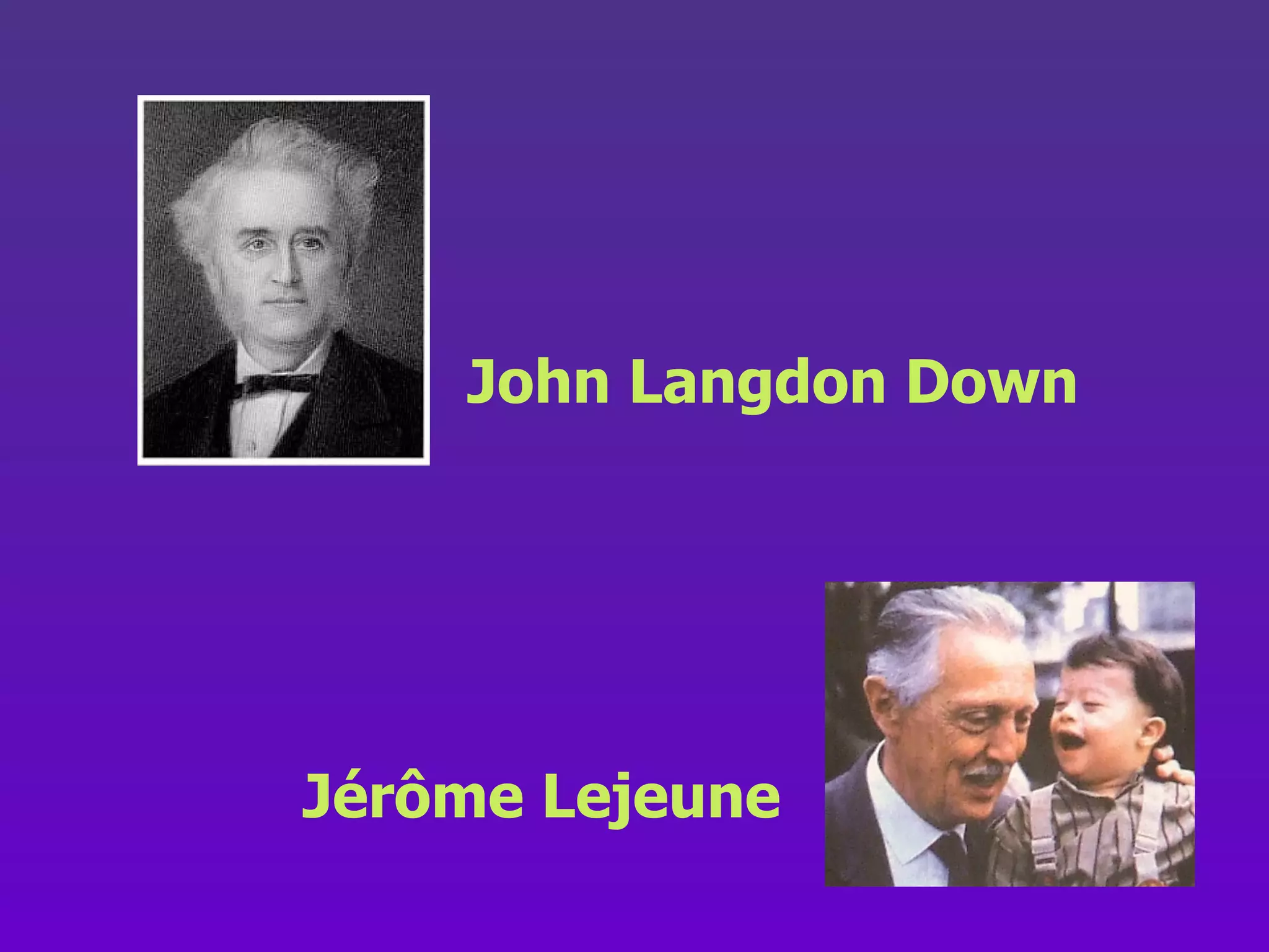 John Langdon Down Jérôme Lejeune 