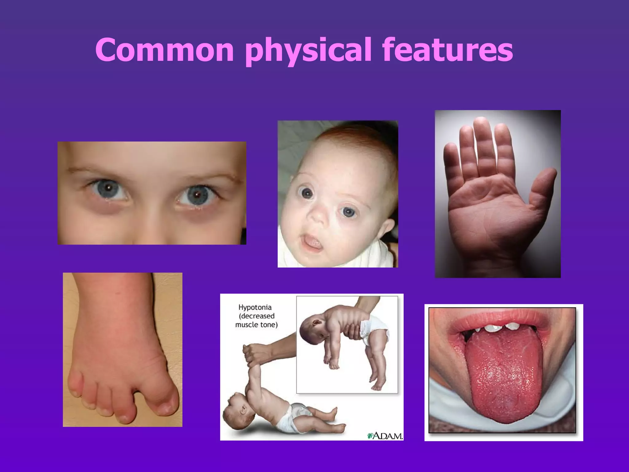 Common physical features 