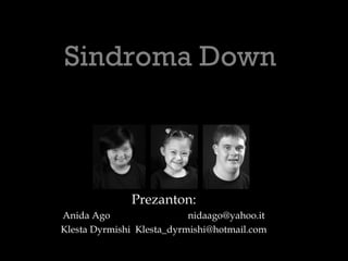 Sindroma Down
Prezanton:
Anida Ago nidaago@yahoo.it
Klesta Dyrmishi Klesta_dyrmishi@hotmail.com
 