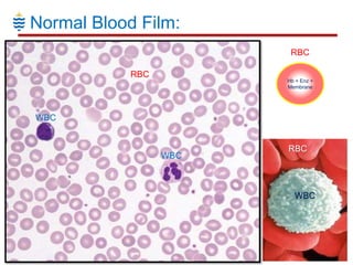 Haematology for Dental Students - RBC Disorders | PPTX