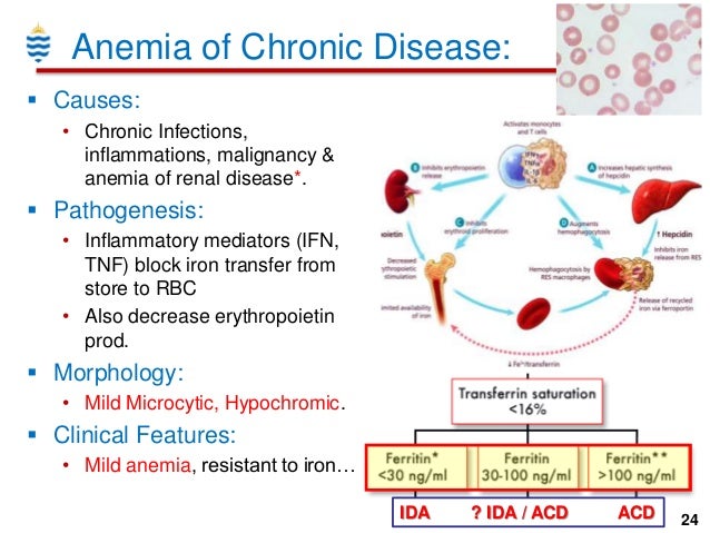 Haematology for Dental Students - RBC Disorders