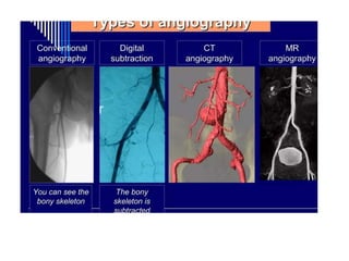 Dsa Scanner DSA -DIGITAL SUBSTRACTION ANGIOGRAPHY TECHNIQUE | PPTX
