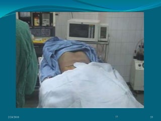 2/24/201039 ArtifactsLagVignetting,Veiling glare Pincushion distortionS distortion. 39