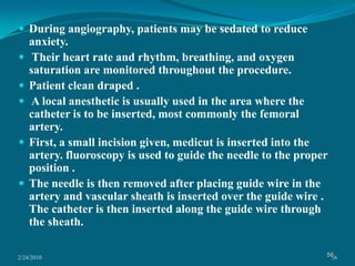 2/24/201040LagLag is the persistence of luminescence after x-ray stimulation has been terminated. 	  Lag degrades the temporal resolution of the dynamic image. 	  Older imageintensifier tubes had phosphors with lag times on the order of 30–40 msec. Current imageintensifier tubes have lag times of approximately 1 msec.VignettingA fall-off in brightness at the periphery of an image is called vignetting. Vignetting is caused by the unequal collection of light at the center of the imageintensifier compared with the light at its periphery. As a result, the center of an imageintensifier has better resolution, increased brightness, and less distortion. 40