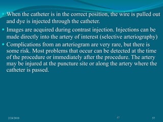 2/24/201041Veiling GlareScattering of light and the defocusing of photoelectrons within the imageintensifier are called veiling glare. Veiling glare degrades object contrast at the output phosphor of the imageintensifier. As mentioned, the contrast ratio is a good measure of determining the veiling glare of an imageintensifier. X-ray, electron, and light scatter all contribute to veiling glare. Pincushion DistortionPincushion distortion is a geometric, nonlinear magnificationacross the image. 
