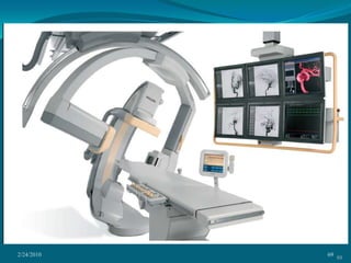 30-40% dilution with normal saline.