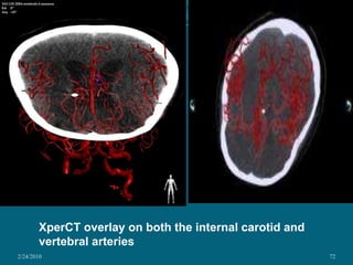 2/24/201048Materials usedSaline