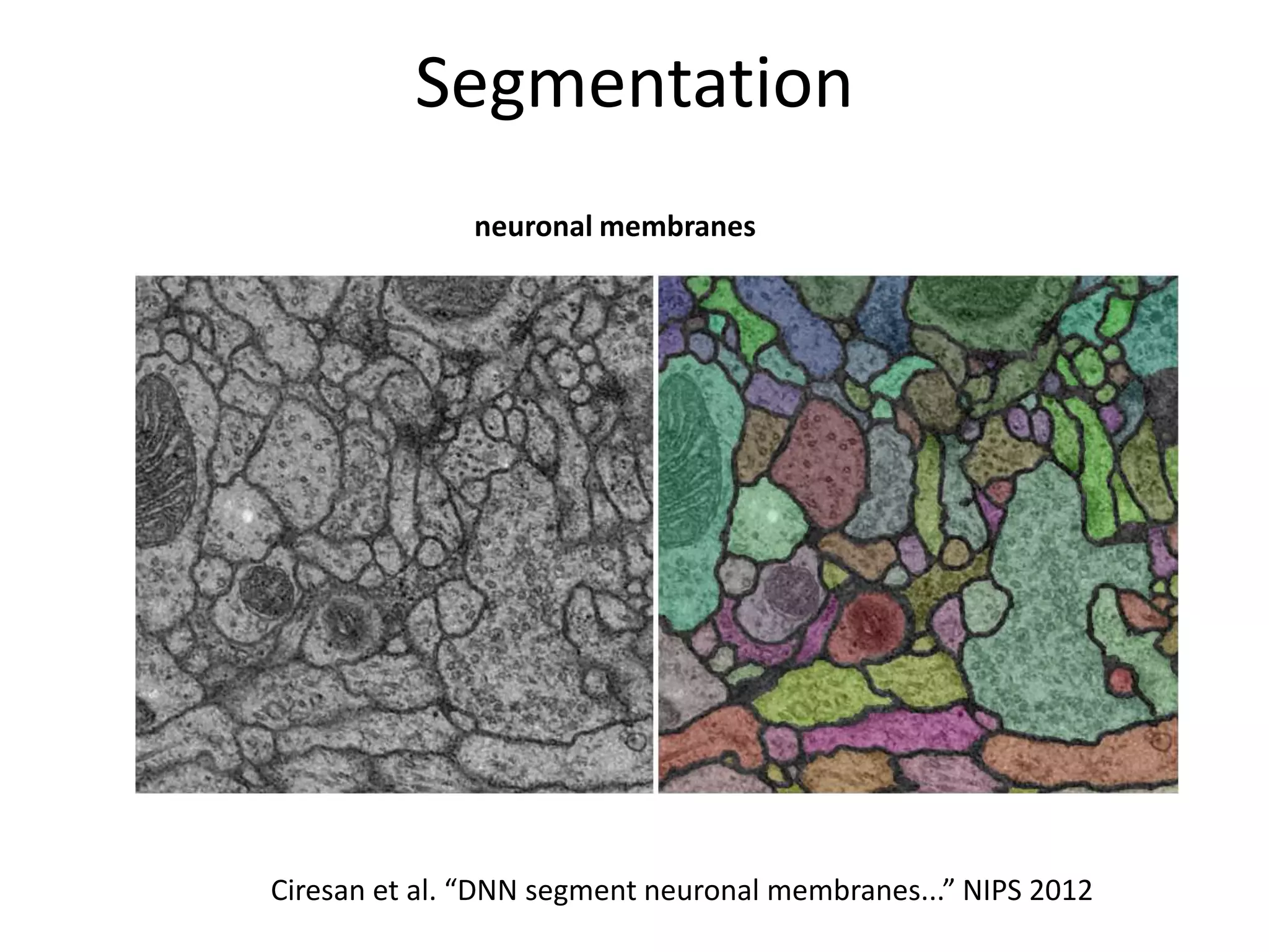 Segmentation
neuronal membranes

Ciresan et al. “DNN segment neuronal membranes...” NIPS 2012

 