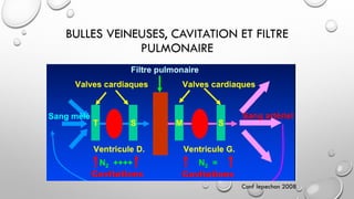 BULLES VEINEUSES, CAVITATION ET FILTRE
PULMONAIRE
Conf lepechon 2008
 