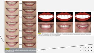 Smile Design Ruler Smile Design | PPTX