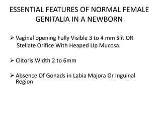 ESSENTIAL FEATURES OF NORMAL FEMALE
GENITALIA IN A NEWBORN
 Vaginal opening Fully Visible 3 to 4 mm Slit OR
Stellate Orifice With Heaped Up Mucosa.
 Clitoris Width 2 to 6mm
 Absence Of Gonads in Labia Majora Or Inguinal
Region
 