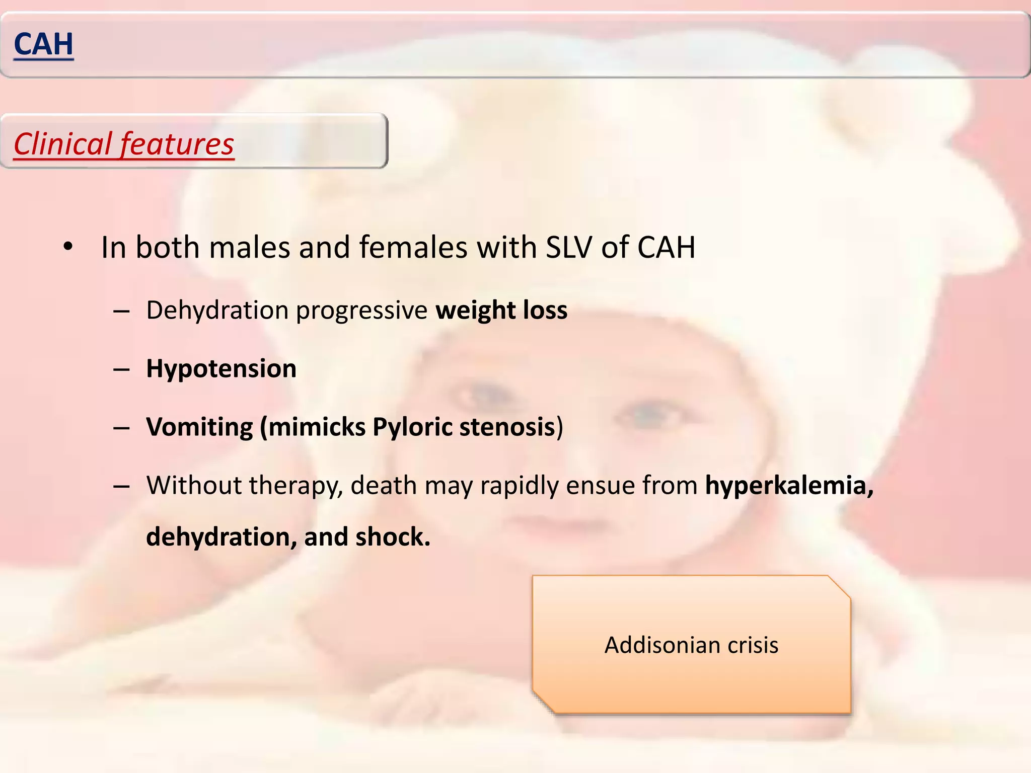 • In both males and females with SLV of CAH
– Dehydration progressive weight loss
– Hypotension
– Vomiting (mimicks Pyloric stenosis)
– Without therapy, death may rapidly ensue from hyperkalemia,
dehydration, and shock.
CAH
Clinical features
Addisonian crisis
 