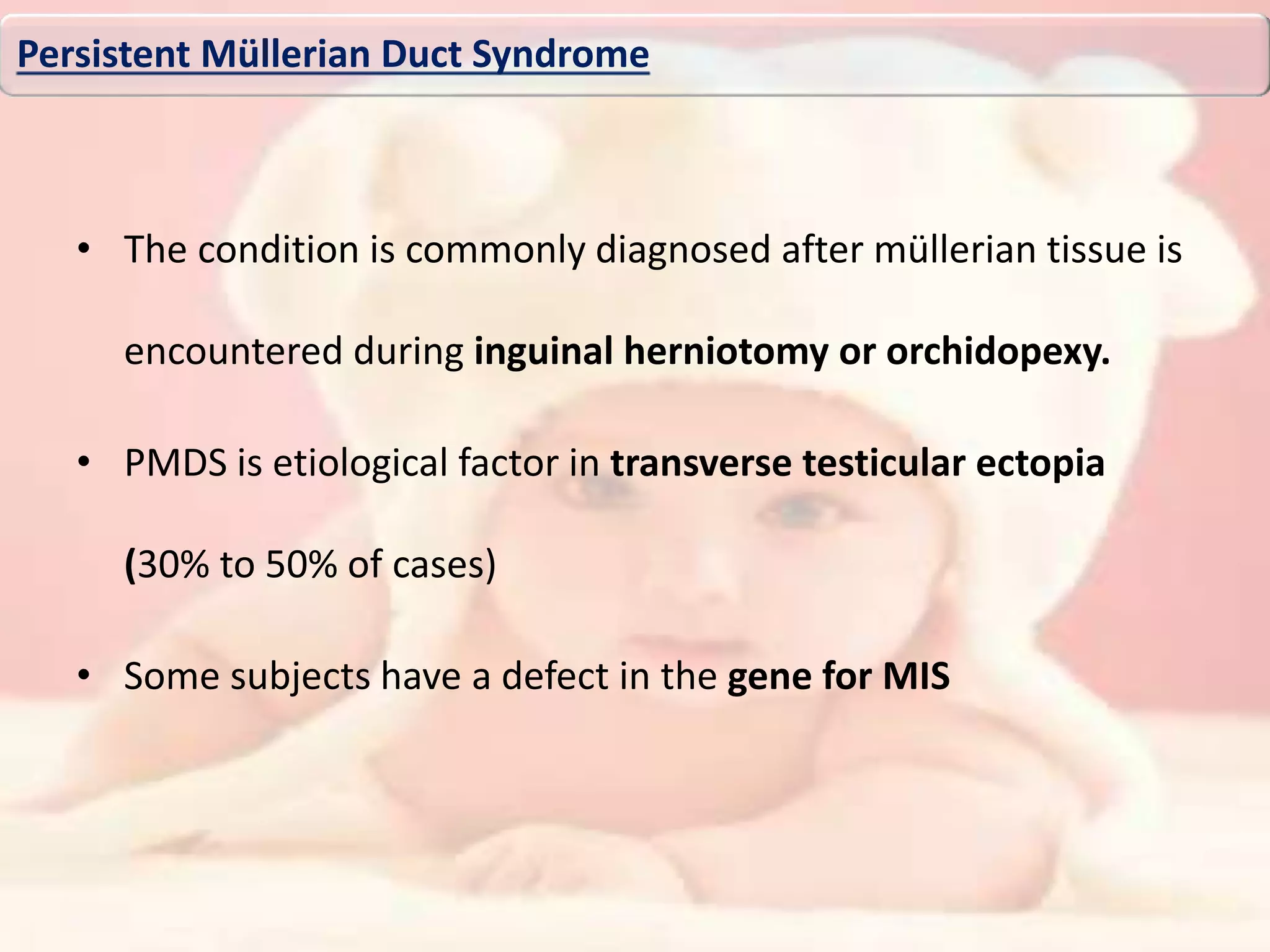 • The condition is commonly diagnosed after müllerian tissue is
encountered during inguinal herniotomy or orchidopexy.
• PMDS is etiological factor in transverse testicular ectopia
(30% to 50% of cases)
• Some subjects have a defect in the gene for MIS
Persistent Müllerian Duct Syndrome
 