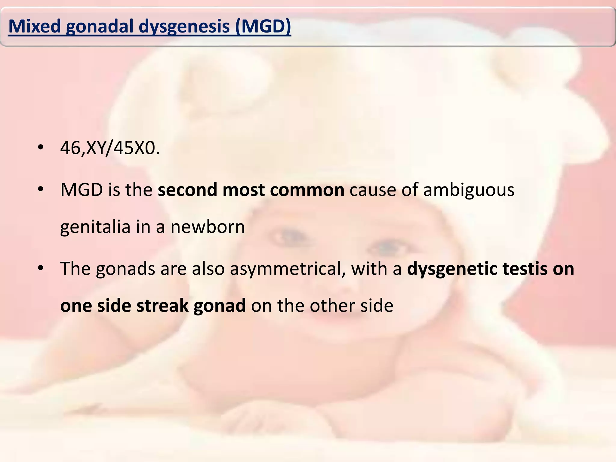 • 46,XY/45X0.
• MGD is the second most common cause of ambiguous
genitalia in a newborn
• The gonads are also asymmetrical, with a dysgenetic testis on
one side streak gonad on the other side
Mixed gonadal dysgenesis (MGD)
 