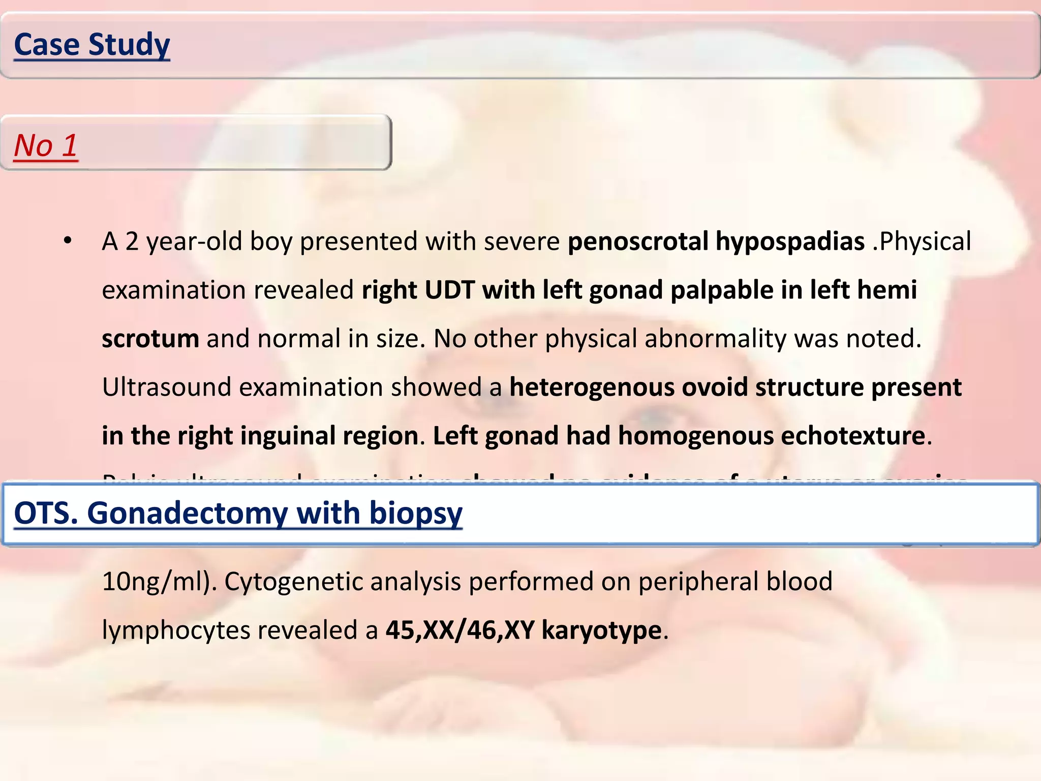 • A 2 year-old boy presented with severe penoscrotal hypospadias .Physical
examination revealed right UDT with left gonad palpable in left hemi
scrotum and normal in size. No other physical abnormality was noted.
Ultrasound examination showed a heterogenous ovoid structure present
in the right inguinal region. Left gonad had homogenous echotexture.
Pelvic ultrasound examination showed no evidence of a uterus or ovaries.
The testosterone levels were measured both were in the normal range (3-
10ng/ml). Cytogenetic analysis performed on peripheral blood
lymphocytes revealed a 45,XX/46,XY karyotype.
Case Study
No 1
OTS. Gonadectomy with biopsy
 