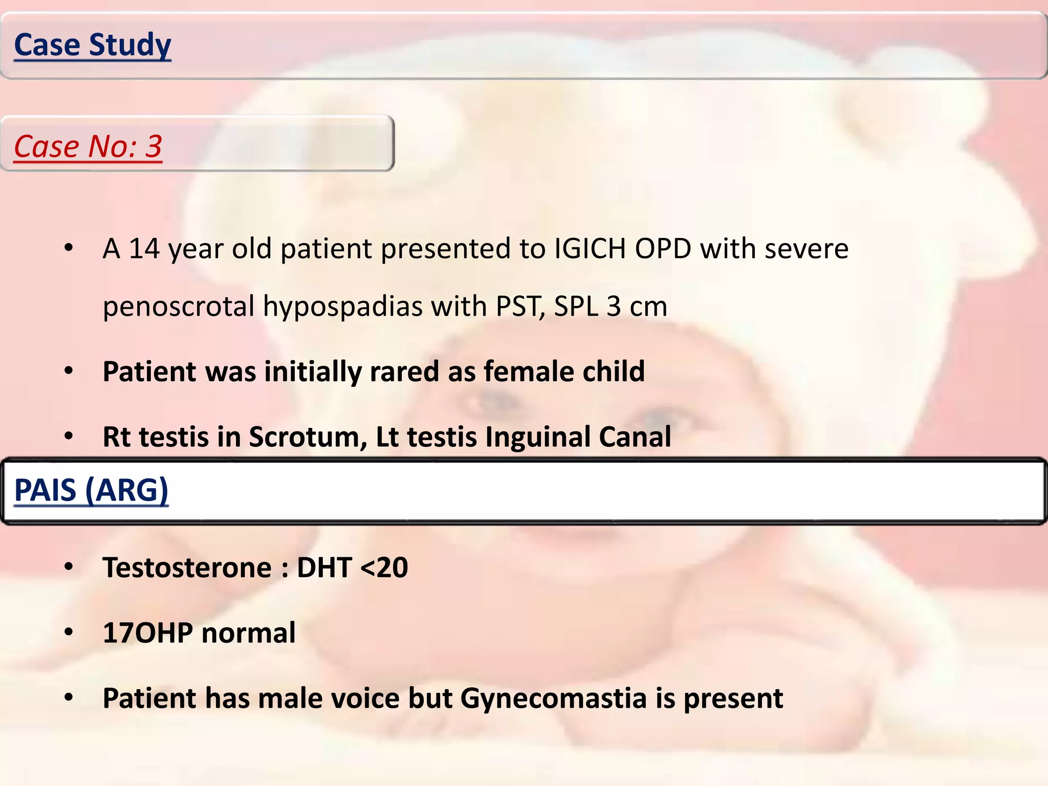 • A 14 year old patient presented to IGICH OPD with severe
penoscrotal hypospadias with PST, SPL 3 cm
• Patient was initially rared as female child
• Rt testis in Scrotum, Lt testis Inguinal Canal
• Testosterone <200 ng/ml
• Testosterone : DHT <20
• 17OHP normal
• Patient has male voice but Gynecomastia is present
Case Study
Case No: 3
PAIS (ARG)
 