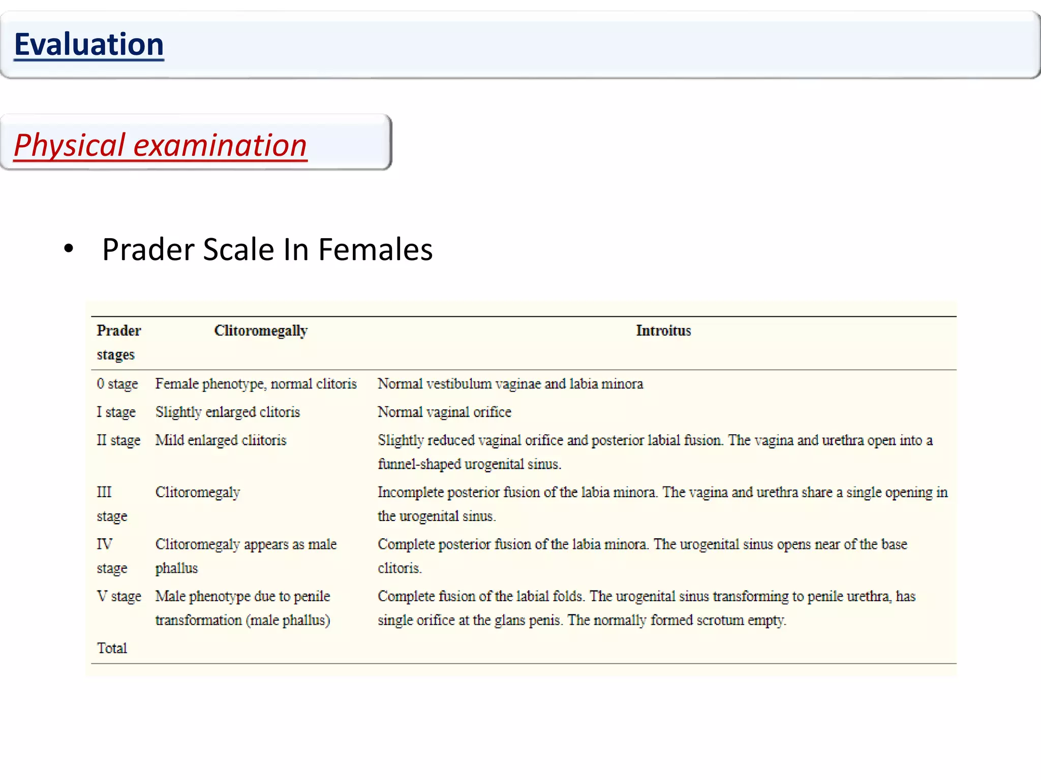 • Prader Scale In Females
Evaluation
Physical examination
 