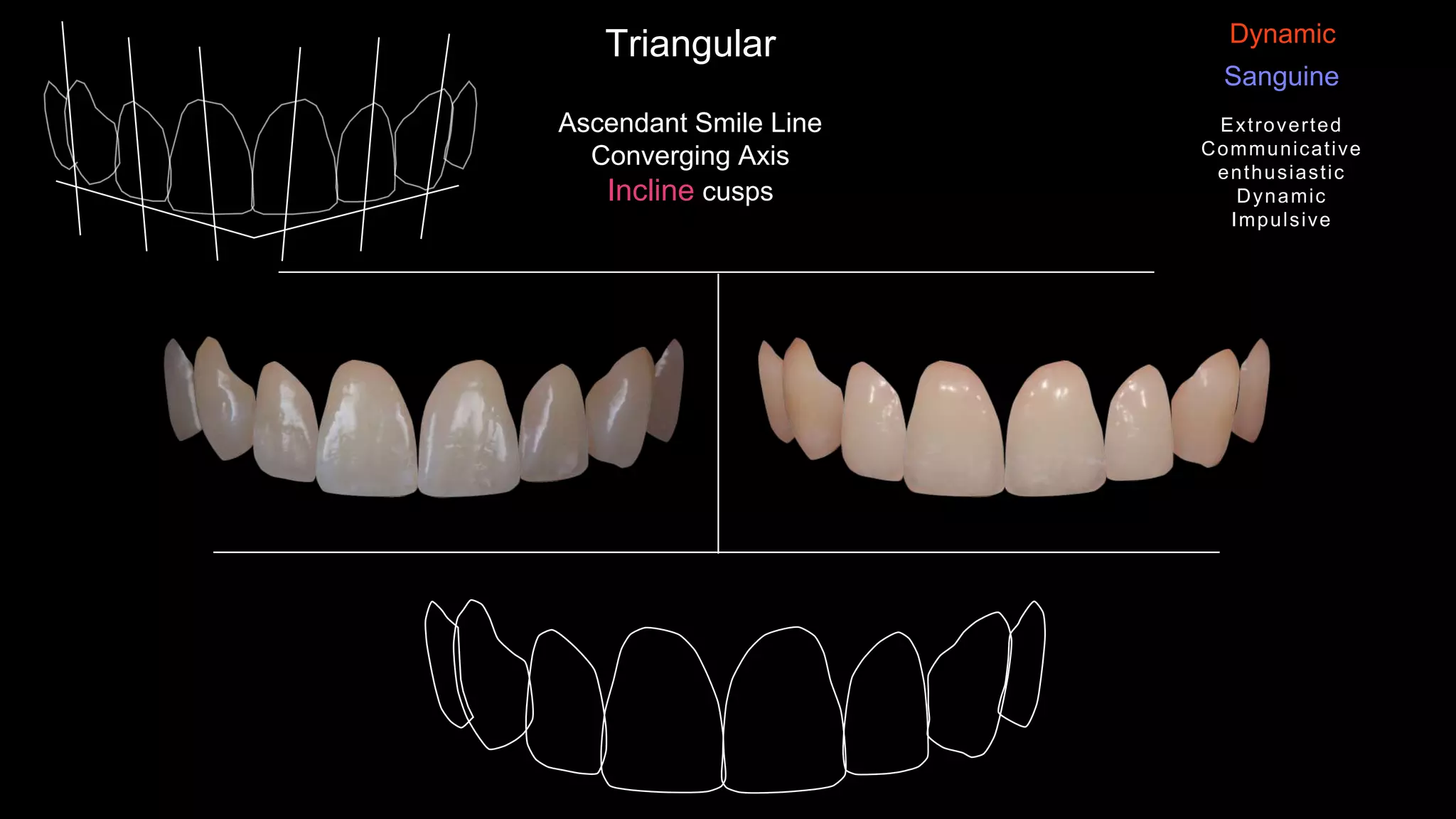 Ascendant Smile Line
Converging Axis
Incline cusps
Triangular
Sanguine
Dynamic
Extroverted
Communicative
enthusiastic
Dynamic
Impulsive
