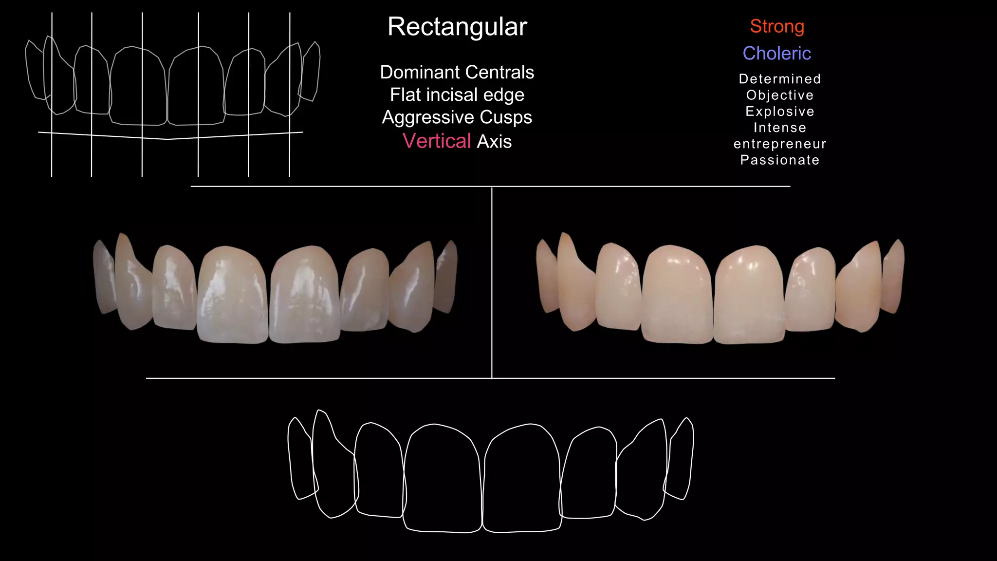 Dominant Centrals
Flat incisal edge
Aggressive Cusps
Vertical Axis
Rectangular
Choleric
Strong
Determined
Objective
Explosive
Intense
entrepreneur
Passionate