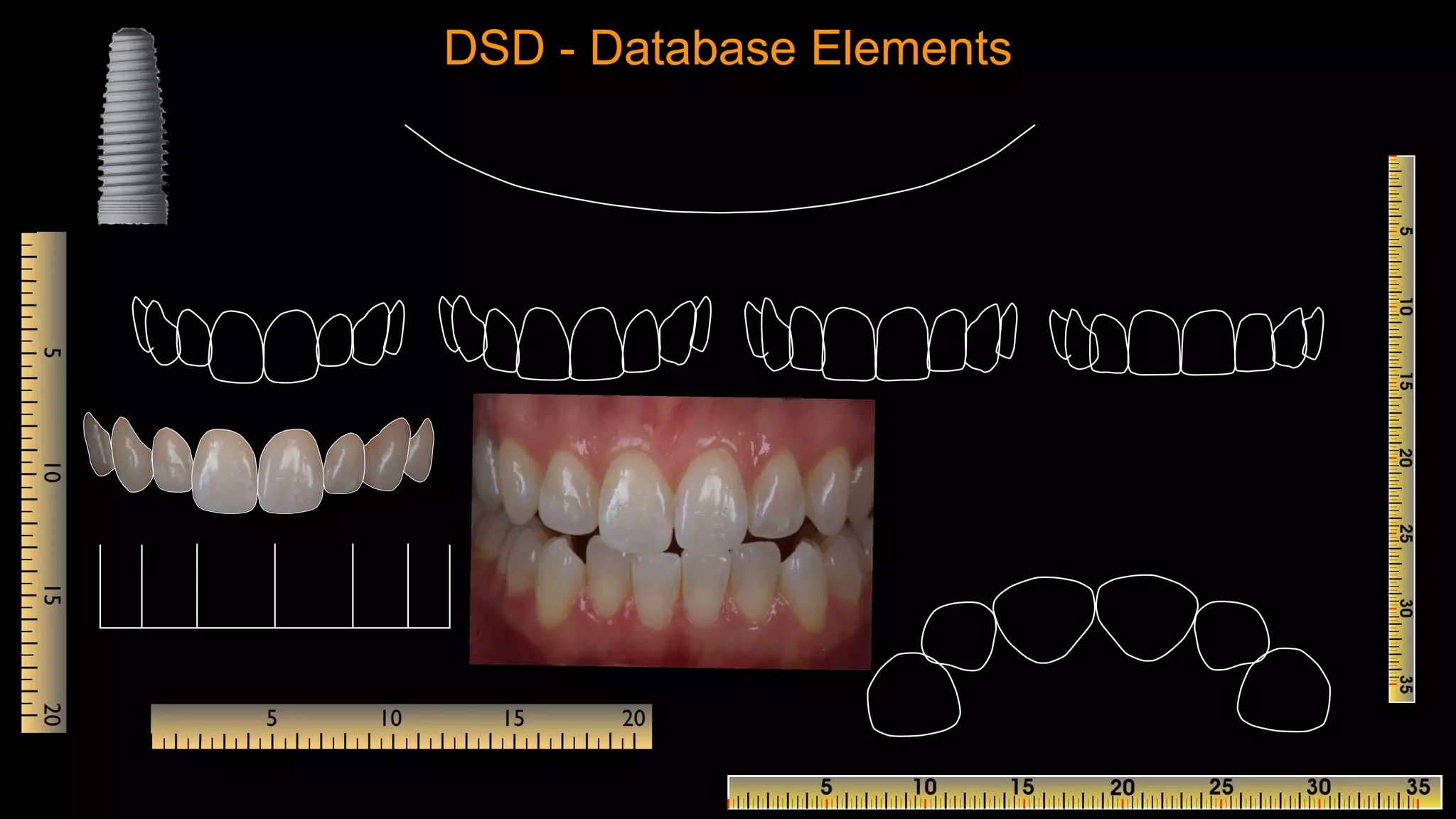 DSD - Database Elements