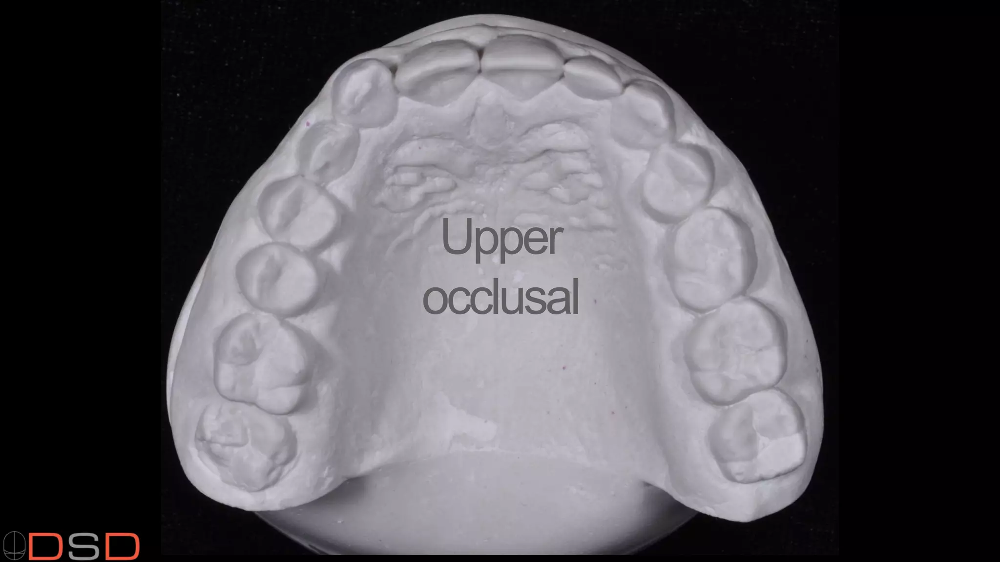 Upper
occlusal