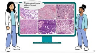 Image source: https://doi.org/10.1016/j.anndiagpath.2020.151490
These are pathology
slides of breast
tissue
13
 