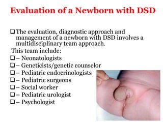 Evaluation of a Newborn with DSD
The evaluation, diagnostic approach and
management of a newborn with DSD involves a
multidisciplinary team approach.
This team include:
– Neonatologists
– Geneticists/genetic counselor
– Pediatric endocrinologists
– Pediatric surgeons
– Social worker
– Pediatric urologist
– Psychologist
 