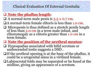 Clinical Evaluation Of External Genitalia
 Note the phallus length:
 A normal-term male penis is 3.5 ± 0.7 cm.
A normal-term female clitoris is less than 1.0 cm.
 Micropenis is thus defined as a stretch penile length
of less than 2.0 cm in a term male infant, and
clitoromegaly as a clitoris greater than 1.0 cm in a
term female.
 Note the position of the urethral meatus:
 Hypospadias associated with bifid scrotum or
undescended testis suggests a DSD .
If the urethral opening is at the base of the phallus, it
could be a urogenital sinus in a virilized female.
Labioscrotal folds may be separated or be fused at the
midline, giving an appearance of a scrotum.
 