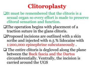 Clitoroplasty
It must be remembered that the clitoris is a
sexual organ so every effort is made to preserve
clitoral sensation and function.
The operation begins with placement of a
traction suture in the glans clitoris.
Proposed incisions are outlined with a skin
scribe and injected with 0.5 % lidocaine with
1:200,000 epinephrine subcutaneously .
 The entire clitoris is degloved along the plane
between the Buck fascia and the Dartos
circumferentially. Ventrally, the incision is
carried around the UGS
 