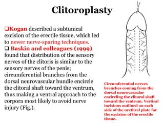 Clitoroplasty
Circumferential nerves
branches coming from the
dorsal neurovascular
encircling the clitoral shaft
toward the ventrum. Vertical
incisions outlined on each
side of the urethral plate for
the excision of the erectile
tissue.
Kogan described a subtunical
excision of the erectile tissue, which led
to newer nerve-sparing techniques.
 Baskin and colleagues (1999)
found that distribution of the sensory
nerves of the clitoris is similar to the
sensory nerves of the penis;
circumferential branches from the
dorsal neurovascular bundle encircle
the clitoral shaft toward the ventrum,
thus making a ventral approach to the
corpora most likely to avoid nerve
injury (Fig.).
 