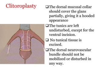 Clitoroplasty The dorsal mucosal collar
should cover the glans
partially, giving it a hooded
appearance
The tunics are left
undisturbed, except for the
ventral incision.
 No tunical tissue is
excised.
The dorsal neurovascular
bundle should not be
mobilized or disturbed in
any way.
 