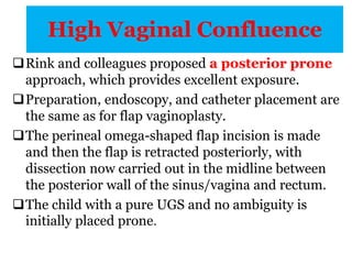 High Vaginal Confluence
Rink and colleagues proposed a posterior prone
approach, which provides excellent exposure.
Preparation, endoscopy, and catheter placement are
the same as for flap vaginoplasty.
The perineal omega-shaped flap incision is made
and then the flap is retracted posteriorly, with
dissection now carried out in the midline between
the posterior wall of the sinus/vagina and rectum.
The child with a pure UGS and no ambiguity is
initially placed prone.
 