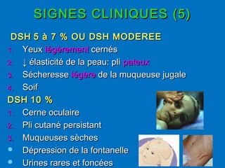 SIGNES CLINIQUES (5)SIGNES CLINIQUES (5)
DSHDSH 5 à 7 % OU DSH MODEREE5 à 7 % OU DSH MODEREE
1.1. YeuxYeux légèrementlégèrement cernéscernés
2.2. ↓↓ élasticité de la peau: pliélasticité de la peau: pli pateuxpateux
3.3. SécheresseSécheresse légèrelégère de la muqueuse jugalede la muqueuse jugale
4.4. SoifSoif
DSHDSH 10 %10 %
1.1. Cerne oculaireCerne oculaire
2.2. Pli cutané persistantPli cutané persistant
3.3. Muqueuses sèchesMuqueuses sèches
 Dépression de la fontanelleDépression de la fontanelle
 Urines rares et foncéesUrines rares et foncées
 